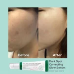 سرم ضد لک و روشن کننده Axis Y مدل Dark Spot Correcting Glow حجم 50 میلی لیتر - Image 6