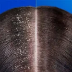 شامپو Head and Shoulders مدل Ekstra Hacim حجم 330 میلی لیتر - Image 3