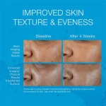 سرم آبرسان Neutrogena مدل Hydro Boost Hyaluronic Acid حجم 15 میلی لیتر - Image 3
